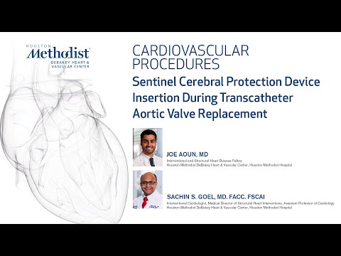 Sentinel Cerebral Protection Device Insertion During Transcatheter Aortic Valve Replacement