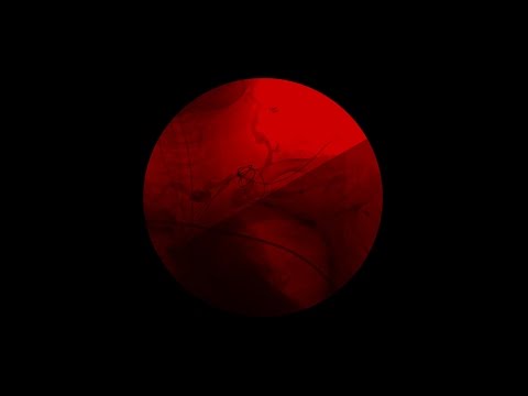 Video thumbnail for Eje Aiye