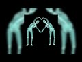Childish Gambino Do Ya Like X Resonance Sped Up