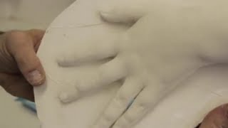 How to: Take a hand cast