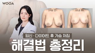 여자 원장이 말하는 처진가슴, 보형물 넣어야 하는 경우가 따로 있다고?