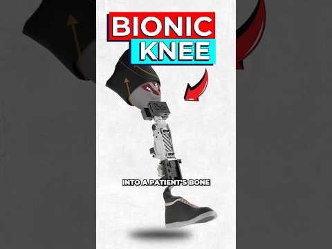 Scientists Create Lifelike Bionic Knee