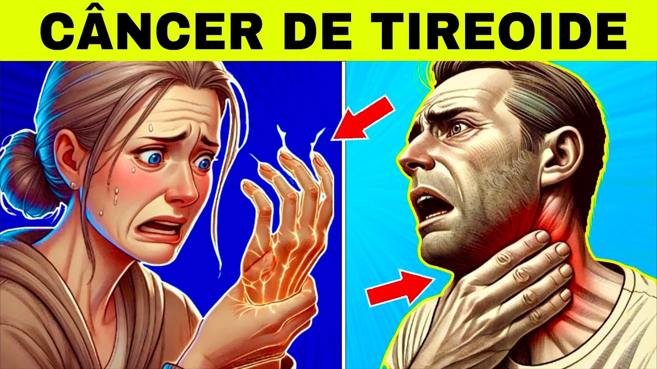 8 Sinais Estranhos de CÂNCER de TIREOIDE (Sintomas de Câncer na Tireoide)