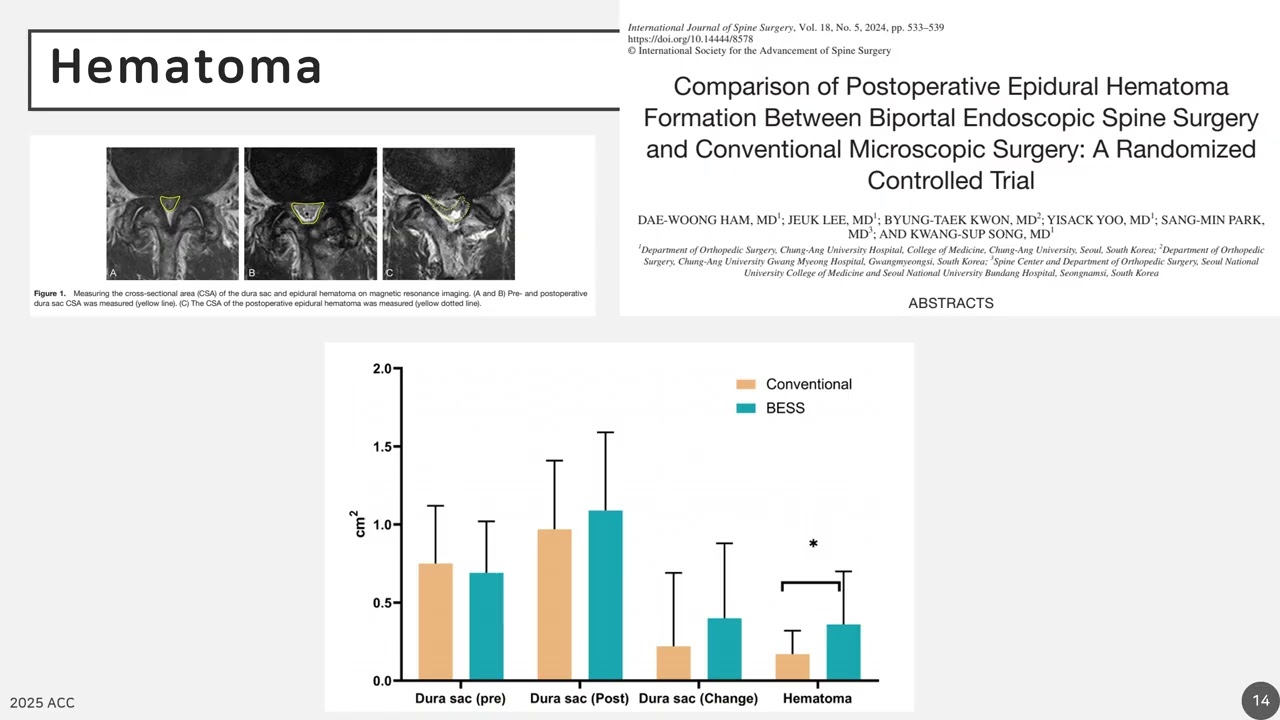 Spine Surgery Lecture Thumbnail