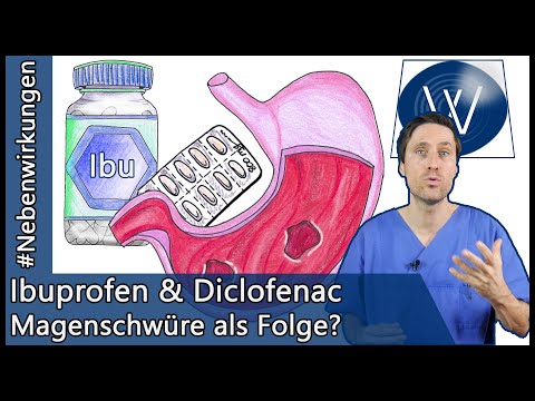 Gefahren bei Ibuprofen & Diclofenac! 5 Tipps bei typischen Nebenwirkungen und häufiger Einnahme