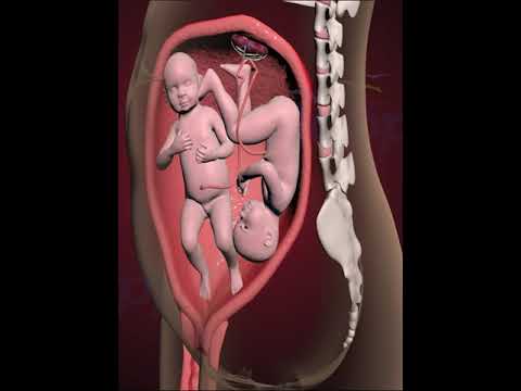 PRECIOUS MOMENTS  OF TWINS FIGHT  INSIDE THE WOMB, FOR SUPREMACY (3D ANIMATION)