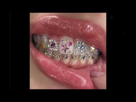 -FREE- 8ruki X Melodic Detroit Type beat "Rehab"