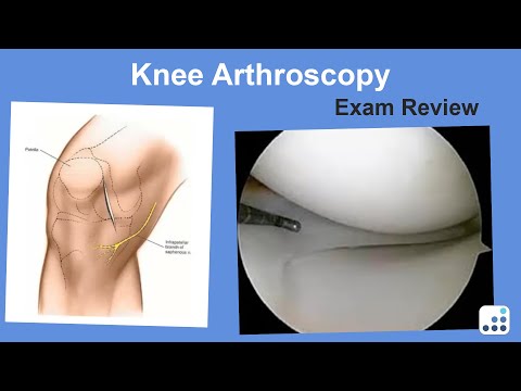 Knee Arthroscopy Exam Review - Ron Delanois, MD