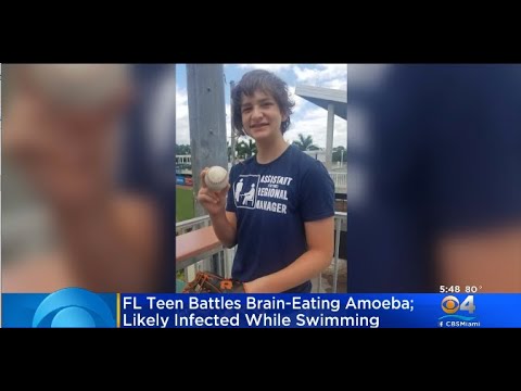 Florida Teen Infected With Brain-Eating Amoeba