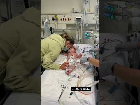 Oliver's Repair Heart Surgery #CHD #marchofdimes #heartsurgery