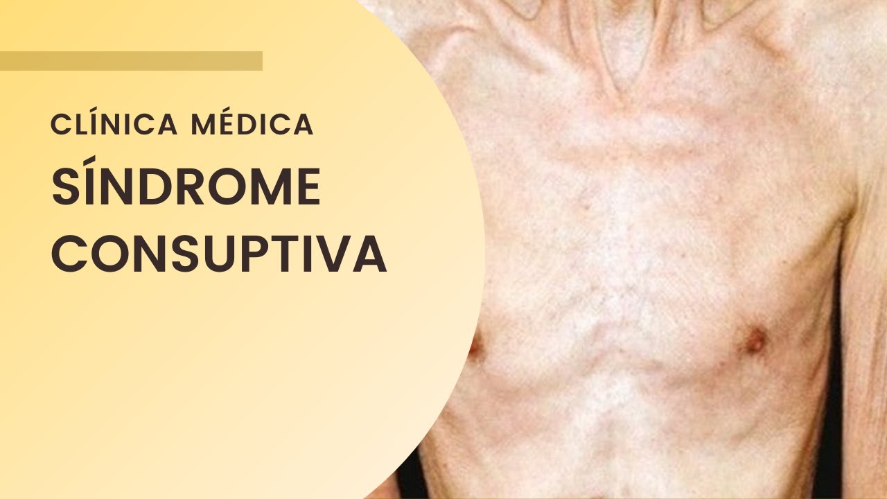 Síndrome Consumptiva