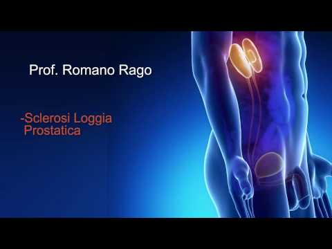 Infiammazione cronica della prostata trattamento Vita per adenoma prostatico