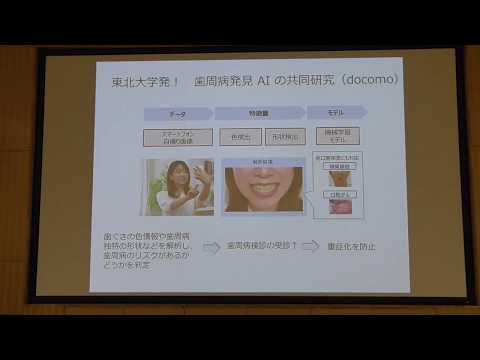 第２回歯学部リエゾン・カフェ「鈴木貞夫教授（名古屋市立大学）とHPVワクチンを語ろう」