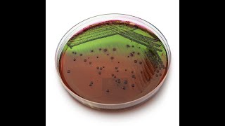 Contagem de coliformes totais, termotolerantes e Escherichia coli
