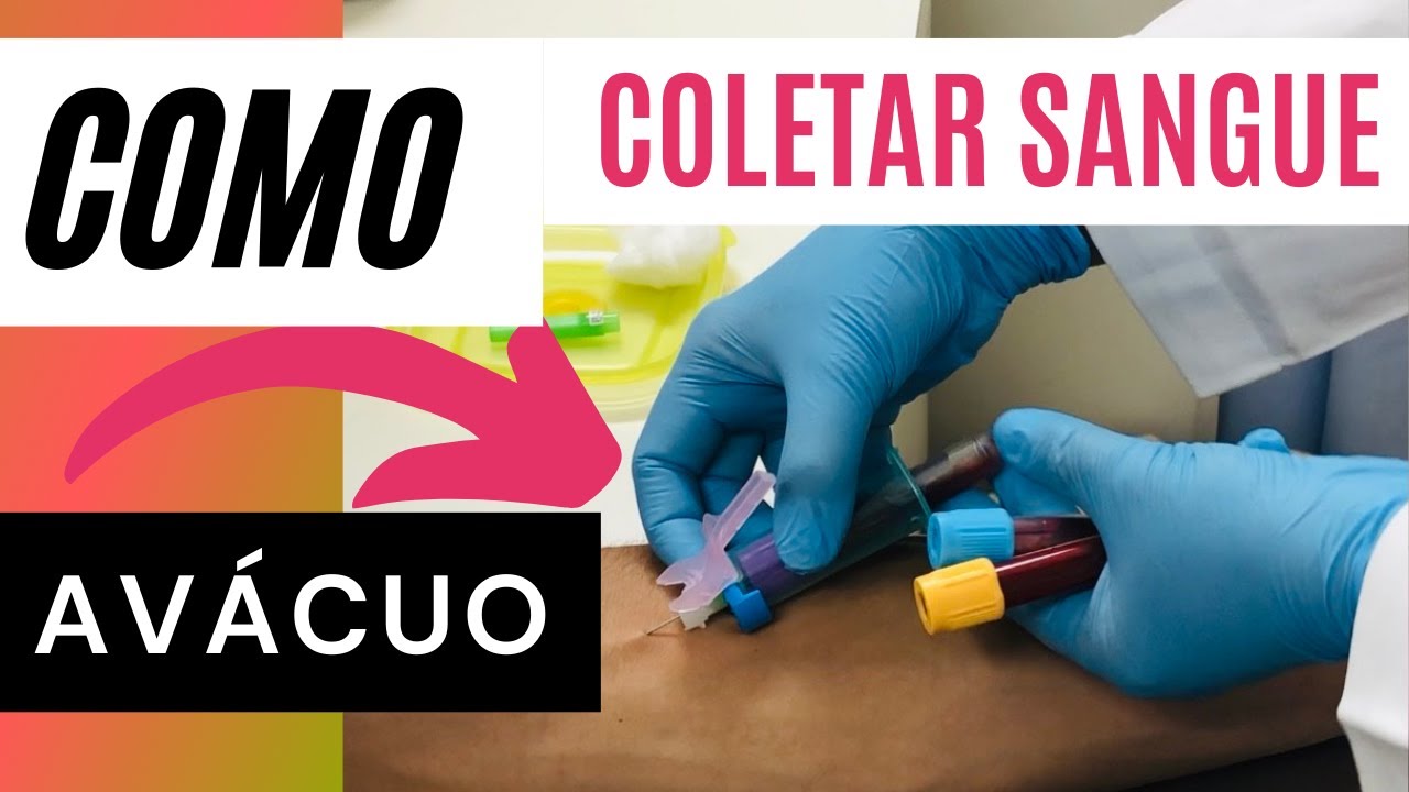 Como Coletar SANGUE NO SISTEMA Á VÁCUO