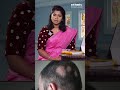 புழுவெட்டு முடி உதிர்வு ஏற்பட காரணம்