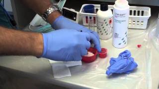 Denture Soft Reline Part 1