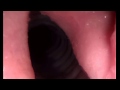 SynDaver Canine Endoscopy