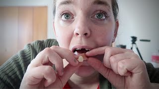 MY DEAD TOOTH | HOW I CARE FOR MY FLIPPER