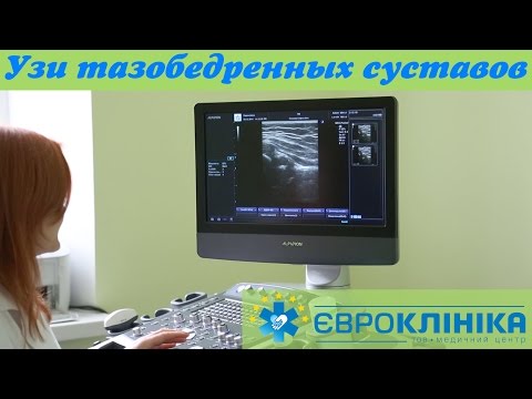 УЗИ ТАЗОБЕДРЕННЫХ СУСТАВОВ!