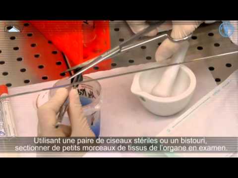 Préparation des échantillons pour l'extraction de l'ARN