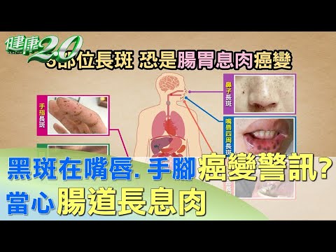 嘴唇黑斑