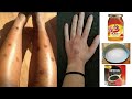 How to get fairer hands and legs | remove sun tan dark spots,rough skin easily with home remedies