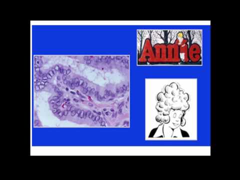 LMP Grand Rounds RLloyd 26Apr2017