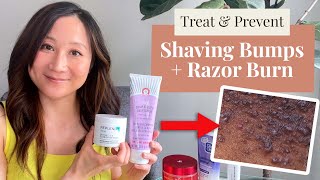 Minimize and Prevent Shaving Bumps & Razor Burn | Dr. Jenny Liu
