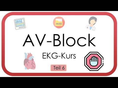 AV block – ECG (PQ interval, Wenckebach, Mobitz)
