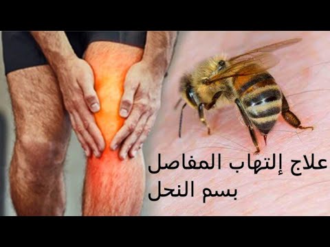 , title : 'علاج إلتهاب المفاصل بسم النحل بالجزائر العاصمة'