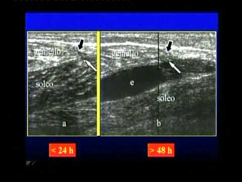 Dolore pancreatite alla schiena tra le scapole Mal di schiena la gotta