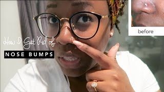 HOW TO GET RID OF A NOSE PIERCING BUMP/ KELOID (FAST!!!) | hellotinashe