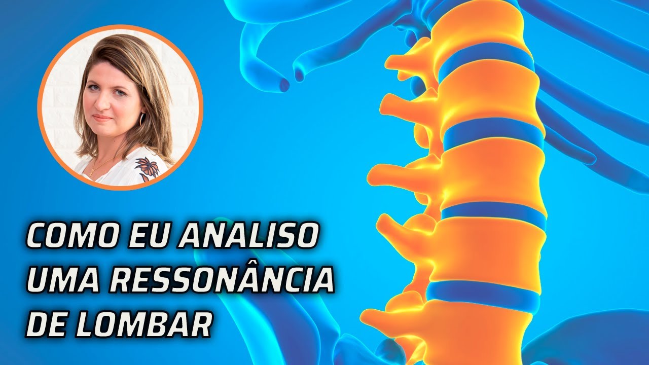 RESSONÂNCIA MAGNÉTICA DA COLUNA LOMBAR PASSO A PASSO