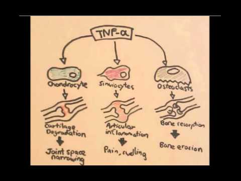 Nociceptors An Introduction to Pain