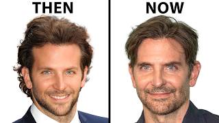 Bradley Cooper's NEW FACE | Plastic Surgery Analysis