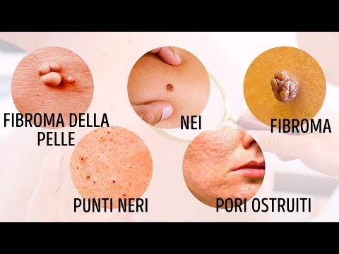 Bevande da parassiti I vermi per trattarli a bambini di una fotografia