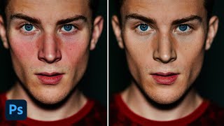Fix red Patches From Skin in Photoshop