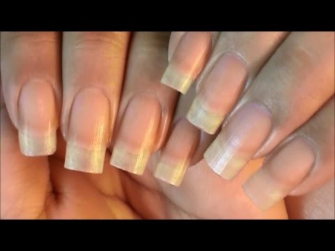 Peeling Nails Treatment & Prevention
