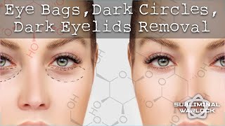 Remove Eye Bags, Dark Circles, Sunken Eyes and Dark Eye Lids! Very Effective 100%