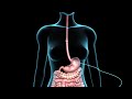 PEG Feeding Tube Nucleus Health