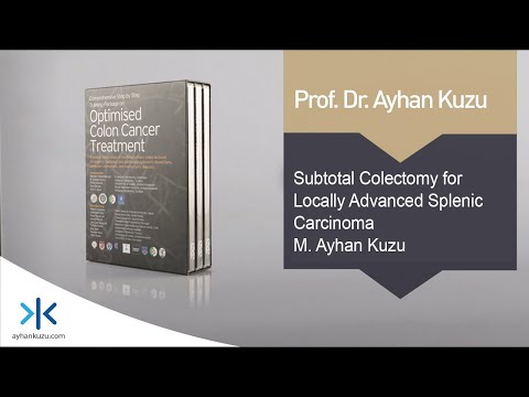 2.2.4. Subtotal Colectomy for Locally Advanced Splenic Carcinoma - M. Ayhan Kuzu