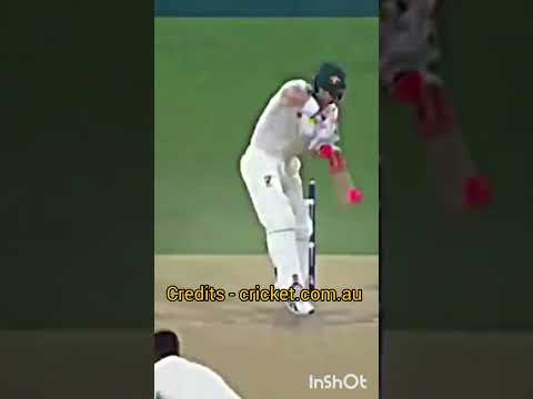 james Anderson showing his class | #cricket #shorts #viral