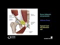 ESSR Webinar 3 2019   Sports Imaging  Imaging athletic groin pain