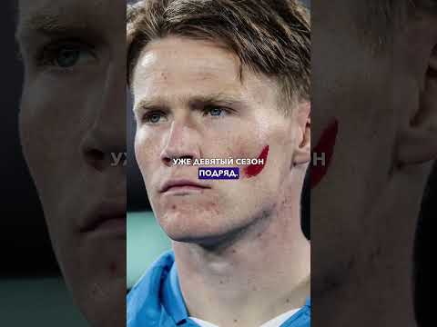 КРАСНЫЕ ПЯТНА НА ЛИЦАХ ФУТБОЛИСТОВ // ЗАЧЕМ В СЕРИИ А ИГРОКИ ДЕЛАЮТ НА ЩЕКАХ КРАСНЫЕ ПОЛОСЫ?