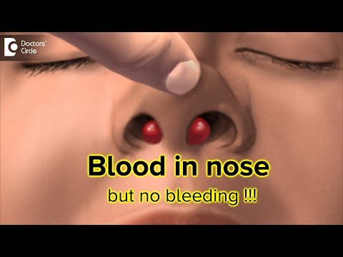 What to do for blood in my nose but there is no bleeding? - Dr.Harihara Murthy