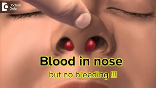 What to do for blood in my nose but there is no bl