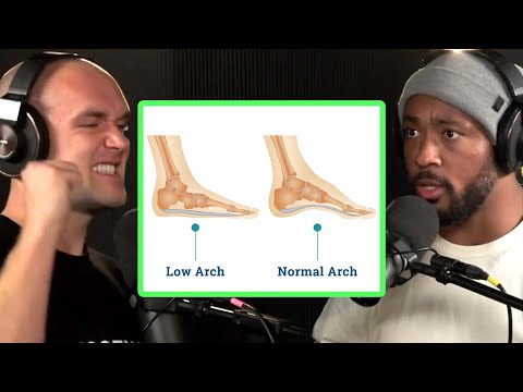 5 Steps to Restore Your Arches