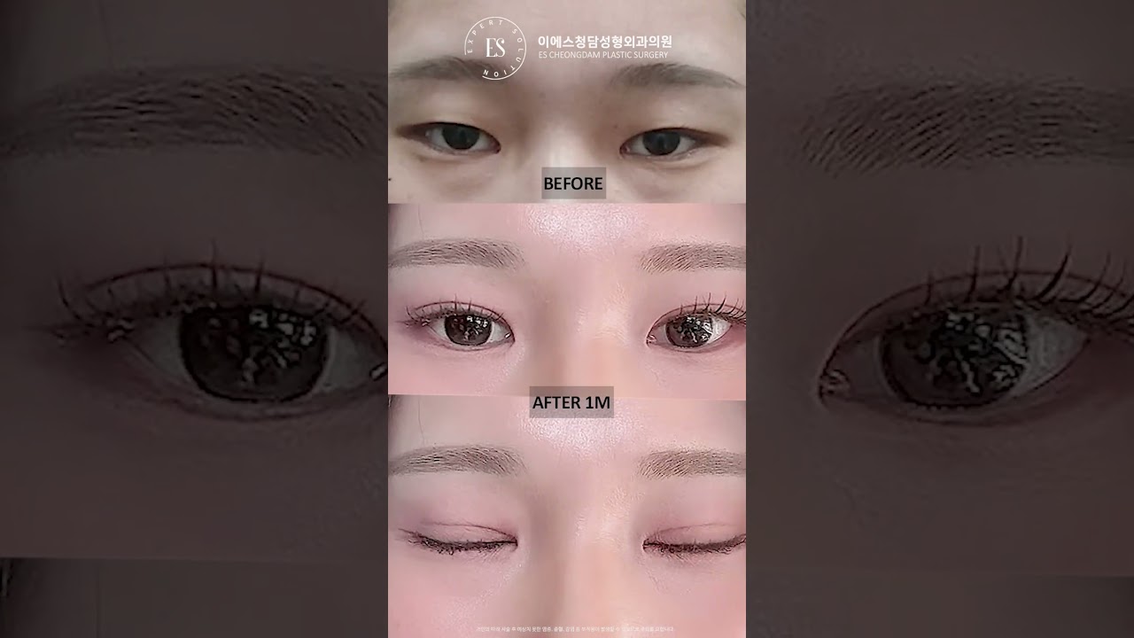 이에스 유튜브