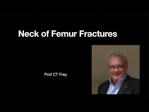 Neck of Femur Fracture in the Elderly